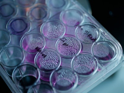 Cancer Cells in a Tray / Image: Suzanne Plunkett